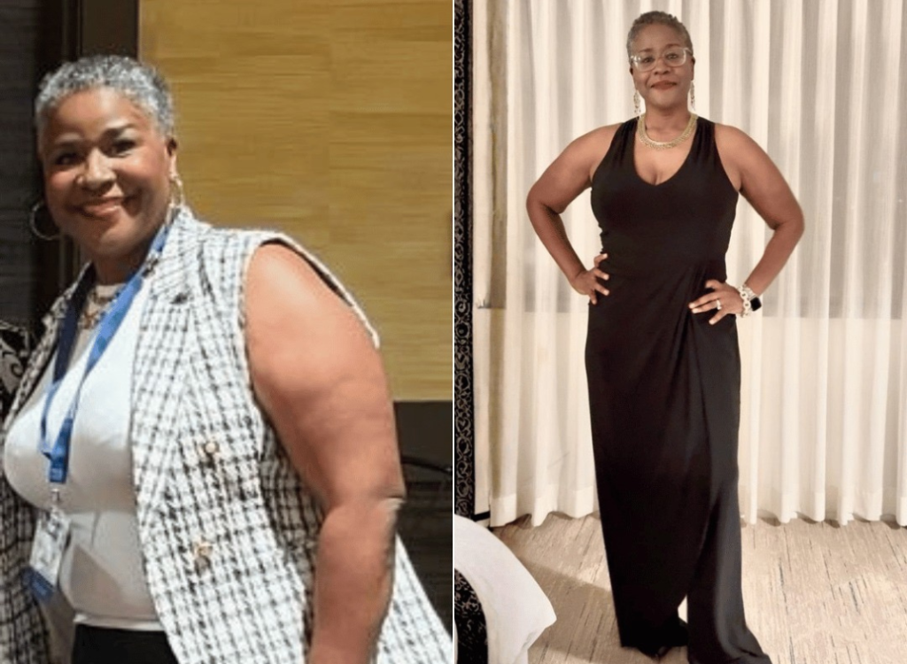 VITAMSPA - BEFORE AND AFTER